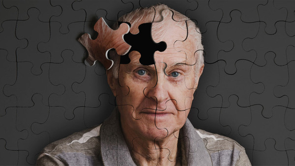 Unutkanlık Tedavisinde Yeni Bir Dönem Başlıyor! O Besinlerden Uzak Duranlar Alzheimerı Kovcacak!