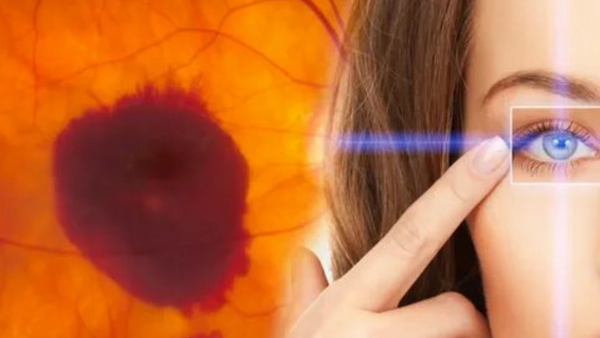 Sarı nokta hastalığına karşı doğal çözüm: Safran! Göz sağlığında en doğal ve etkili mucizevi ürün..