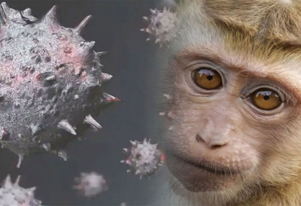 Yaşamı tehdit eden Maymun çiçeği virüsü nasıl fark edilir? Belirtileri ve tedavi metodu…
