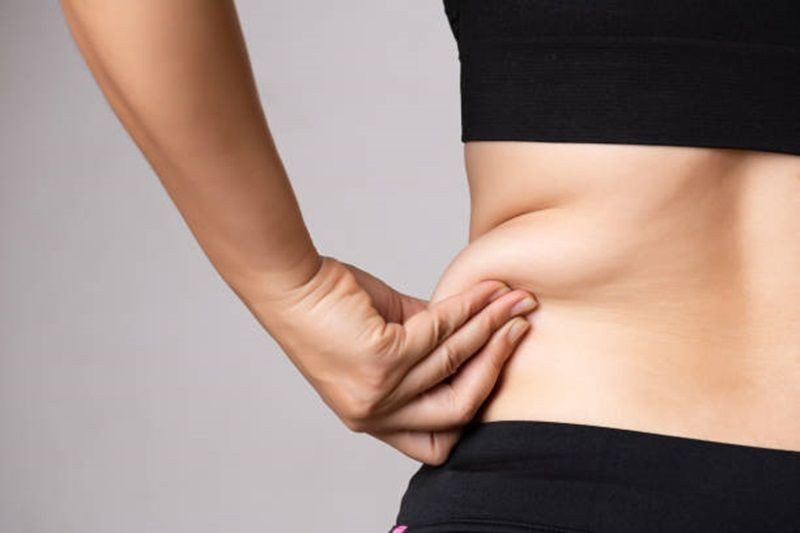 Liposuction Karın Germe Nasıl Yapılır? - Resim: 1