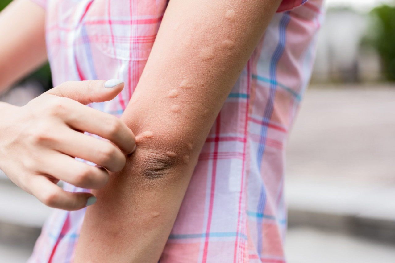 Sıcak havalar kronik hastalar için tehlike çanlarını çalıyor: Uzmanlardan Diyabet hastalarına sivrisinek ve sıcak uyarısı! - Resim : 3