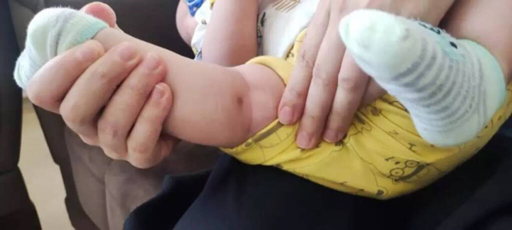 Adem bebek doğduğundan beri ağlıyordu sebebi bulundu: Vücudundan bakın ne çıktı!: Hastanede yaşanan skandal olay - Resim : 1