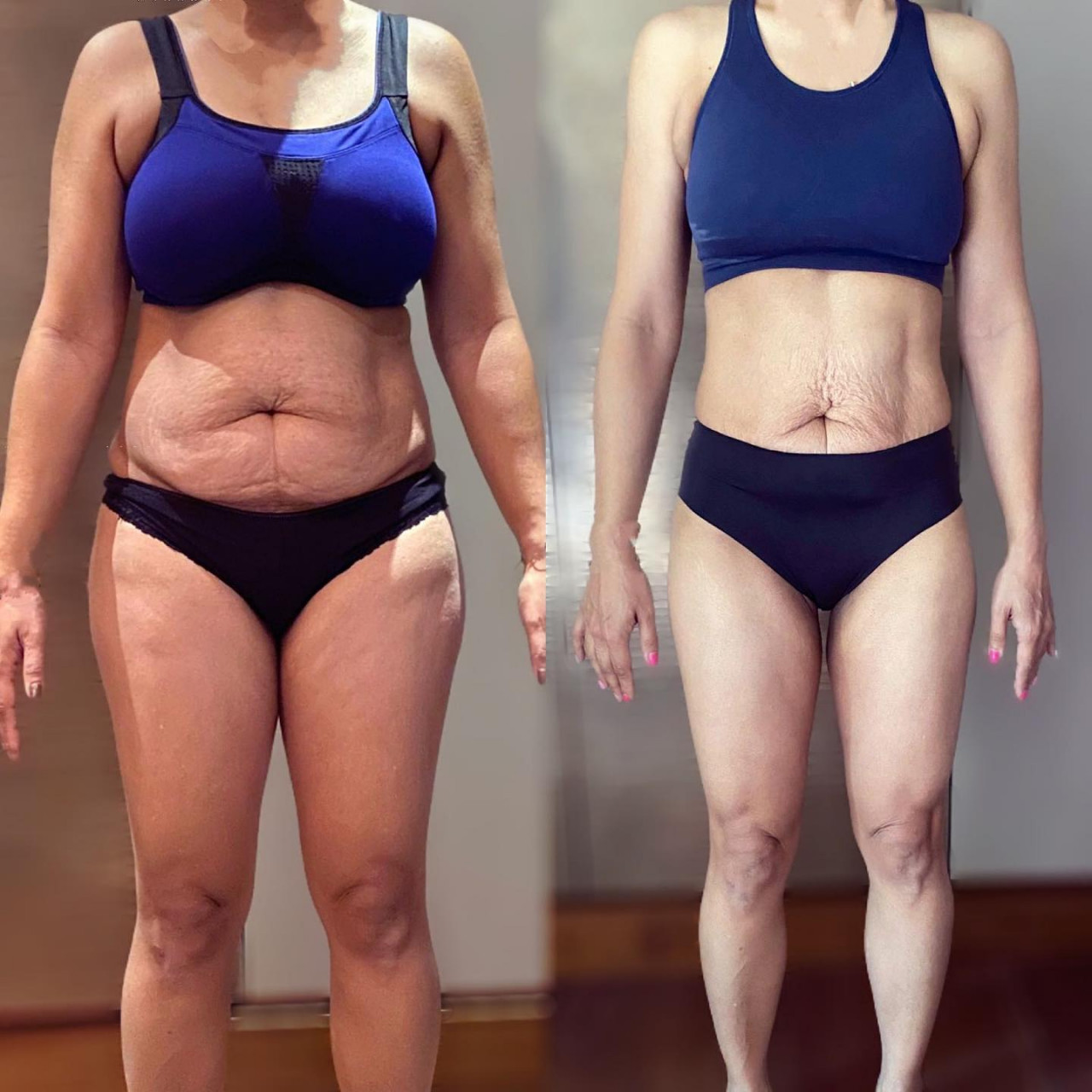 Ameliyatsız, sağlıklı ve doğal yöntem: 6 ayda 30 kilo veren 3 çocuk sahibi kadın, zayıflamanın sırrını paylaştı - Resim : 3