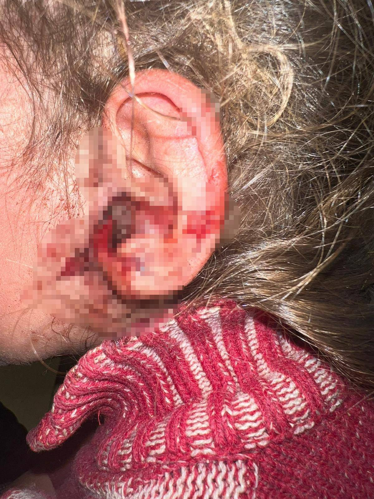 3 yaşındaki kızı kulak kaşıntısıyla hastaneye götürdüler: Doktor, kulağından çıkanları görünce şok oldu! Tam 23 tane canlı canlı - Resim : 1