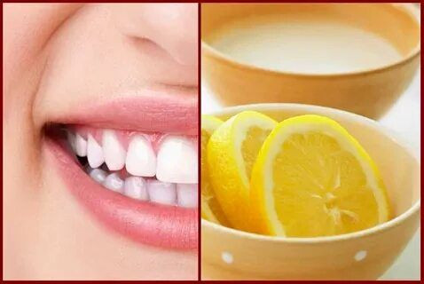 Dişleriniz için doğal bakım: Evde uygulayabileceğiniz 5 diş beyazlatma yöntemi - Resim: 1